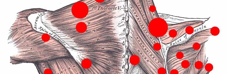 trigger-point-muscoli-schiena