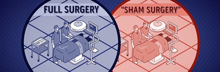 chirugia reale vs chirugia sham